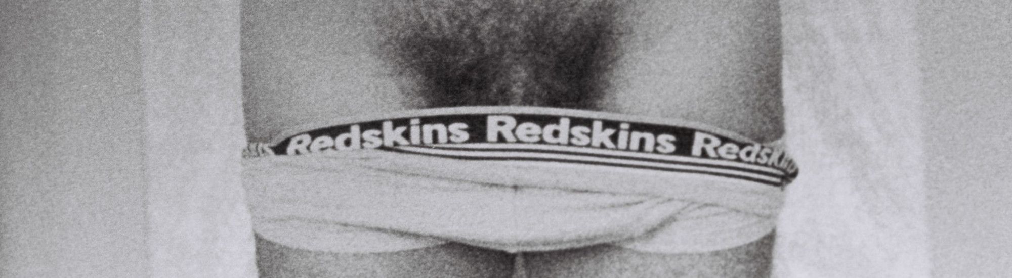 Redskins